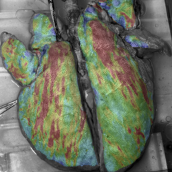 Research Area Image - lung