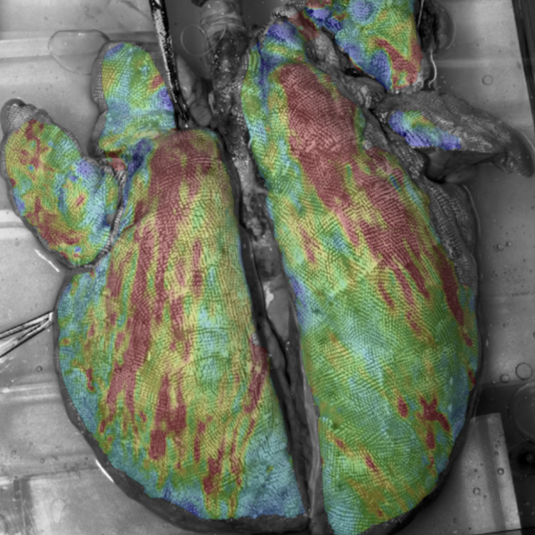 Research Area Image - lung